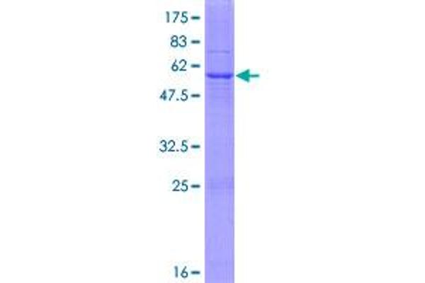 HSD17B3 Protein (AA 1-310) (GST tag)