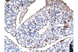 Immunohistochemistry (Paraffin-embedded Sections) (IHC (p)) image for anti-ATP-Binding Cassette, Sub-Family B (MDR/TAP), Member 11 (ABCB11) (AA 21-120) antibody (ABIN675848)