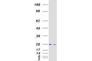 Ubiquitin-Conjugating Enzyme E2S (UBE2S) protein (Myc-DYKDDDDK Tag)