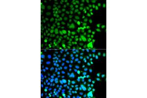 Immunofluorescence analysis of A549 cells using AEBP2 antibody (ABIN5975286). (AEBP2 抗体)
