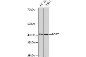 Western blot analysis of extracts of various cell lines, using BGAT Rabbit mAb (ABIN7267664) at 1:1000 dilution. (ABO 抗体)
