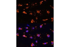 Immunofluorescence analysis of L929 cells using CD172a/SIRPα Rabbit pAb (ABIN6130058, ABIN6147780, ABIN6147781 and ABIN6224854) at dilution of 1:100 (40x lens). (SIRPA 抗体  (AA 395-504))