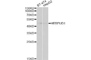 Western blot analysis of extracts of various cell lines, using HERPUD1 antibody (ABIN6292373) at 1:1000 dilution. (HERPUD1 抗体)