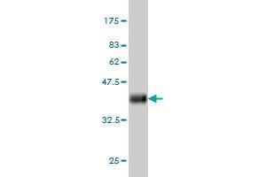 Western Blot detection against Immunogen (35. (PDE2A 抗体  (AA 850-940))