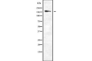 DAP Kinase 1 antibody  (Internal Region)