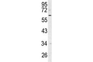 Western blot analysis of RIPK3 antibody and Ramos lysate. (RIPK3 抗体  (AA 1-30))