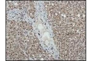 Immunohistochemistry (IHC) image for anti-Nitric Oxide Synthase 2, Inducible (NOS2) antibody (ABIN870301) (NOS2 抗体)