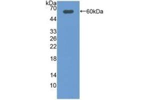 Western Blotting (WB) image for anti-Deiodinase, Iodothyronine, Type II (DIO2) (AA 30-259) antibody (ABIN7435235)