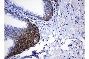 Image no. 8 for anti-NADH Dehydrogenase (Ubiquinone) 1 beta Subcomplex, 10, 22kDa (NDUFB10) antibody (ABIN1499672) (NDUFB10 抗体)