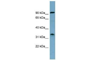 WB Suggested Anti-SDS Antibody Titration:  0. (serine Dehydratase 抗体  (Middle Region))