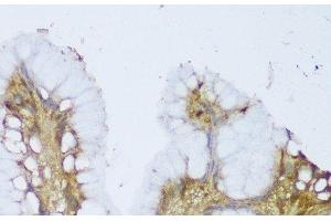 Immunohistochemistry of paraffin-embedded Human stomach using GCN1L1 Polyclonal Antibody at dilution of 1:150 (40x lens). (GCN1L1 抗体)