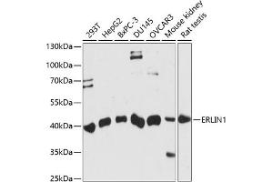 Western blot analysis of extracts of various cell lines, using ERLIN1 antibody (ABIN7267005) at 1:1000 dilution. (ERLIN1 抗体  (AA 259-348))