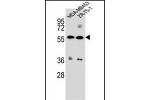 ABCG4 Antibody (N-term) (ABIN656651 and ABIN2845892) western blot analysis in MDA-M,ZR-75-1 cell line lysates (35 μg/lane). (ABCG4 抗体  (N-Term))