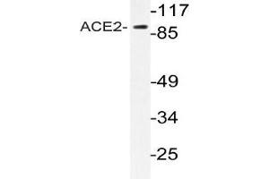 Western blot (WB) analyzes of ACE2 antibody in extracts from HeLa cells. (ACE2 抗体)