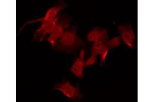 ABIN6267609 staining NIH-3T3 by IF/ICC. (FAK 抗体  (pTyr925))