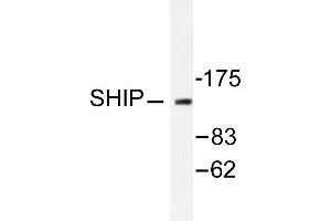 Image no. 1 for anti-Inositol Polyphosphate-5-Phosphatase, 145kDa (INPP5D) antibody (ABIN271812) (INPP5D 抗体)