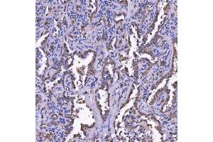 IHC analysis of TOM1L1 using anti-TOM1L1 antibody (ABIN7602631). (TOM1L1 抗体  (AA 9-448))