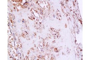 Immunohistochemistry (Paraffin-embedded Sections) (IHC (p)) image for anti-Estrogen Receptor 1 (ESR1) (pSer167) antibody (ABIN729493)