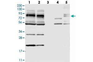 Western blot analysis of Lane 1: RT-4, Lane 2: U-251 MG, Lane 3: Human Plasma, Lane 4: Liver, Lane 5: Tonsil with MAK10 polyclonal antibody .