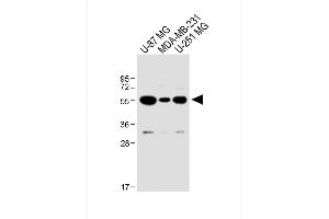 All lanes : Anti-USP17L24 Antibody (C-term) at 1:1000 dilution Lane 1: U-87 MG whole cell lysate Lane 2: MDA-MB-231 whole cell lysate Lane 3: U-251 MG whole cell lysate Lysates/proteins at 20 μg per lane. (USP17L24 抗体  (C-Term))