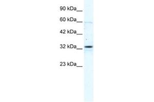 Western Blotting (WB) image for anti-Gap Junction Protein, beta 1, 32kDa (GJB1) antibody (ABIN2461383)