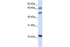 UNCX antibody used at 0. (UNCX 抗体  (N-Term))