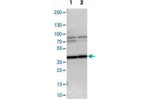 Western blot analysis of cell lysates with WBSCR17 polyclonal antibody . (WBSCR17 抗体)