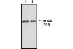 Image no. 1 for anti-Guanine Nucleotide Binding Protein (G Protein), beta 5 (GNB5) antibody (ABIN265062) (GNB5 抗体)