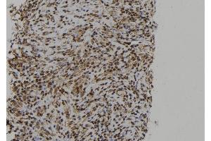 Immunohistochemistry (IHC) image for anti-Protein Tyrosine Phosphatase, Non Receptor Type 23 (PTPN23) (C-Term) antibody (ABIN6264519)