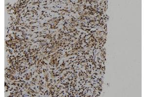 ABIN6273013 at 1/100 staining Human spleen tissue by IHC-P. (PTPN23 抗体  (C-Term))