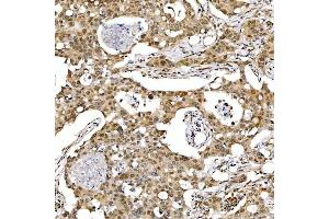 IHC analysis of SMARCA2/BRM using anti-SMARCA2/BRM antibody (ABIN7601969).