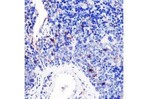 Immunohistochemistry (IHC) image for anti-Tumor Necrosis Factor Receptor Superfamily, Member 9 (TNFRSF9) (AA 150-250) antibody (ABIN7271073)