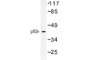 Image no. 1 for anti-Tumor Protein P53 (TP53) antibody (ABIN272156) (p53 抗体)
