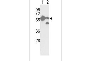 Western blot analysis of hPKM2-  in  cell line(lane 1) and mouse brain tissue(lane 2) lysates (35 μg/lane). (PKM2 抗体  (C-Term))