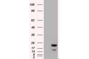 Western Blotting (WB) image for anti-RAB17, Member RAS Oncogene Family (RAB17) antibody (ABIN1500538) (RAB17 抗体)