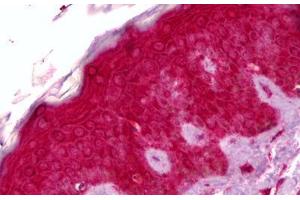 Anti-GPNMB antibody IHC staining of human skin. (Osteoactivin 抗体  (AA 1-572))