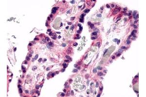 Immunohistochemical staining of Placenta (Villi) using anti- GPR78 antibody ABIN122184