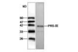 Image no. 1 for anti-phosphoribosyl Pyrophosphate Synthetase 1-Like 1 (PRPS1L1) antibody (ABIN791432) (PRPS1L1 抗体)