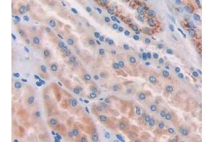 DAB staining on IHC-P; Samples: Human Kidney Tissue (Nicastrin 抗体  (AA 420-655))