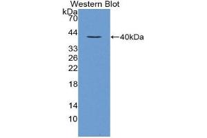 Western Blotting (WB) image for anti-Loricrin (LOR) (AA 210-295) antibody (ABIN1869002) (LOR 抗体  (AA 210-295))