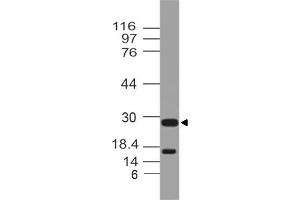 Image no. 1 for anti-Cytokine Receptor-Like Factor 2 (CRLF2) (AA 102-310) antibody (ABIN5027603) (CRLF2 抗体  (AA 102-310))