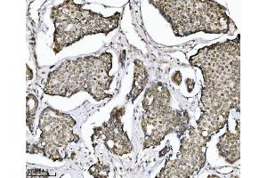 IHC analysis of TRIM24 using anti-TRIM24 antibody (ABIN7602358).