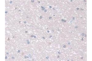 Immunohistochemistry (IHC) image for anti-Actin Related Protein 2/3 Complex, Subunit 2, 34kDa (ARPC2) (AA 1-300) antibody (ABIN7441580)
