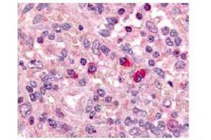 Immunohistochemical staining of ARTEMIS in Formalin fixed and Paraffin embeddes human spleen using antibody ABIN117935. (DCLRE1C 抗体  (AA 482-495))