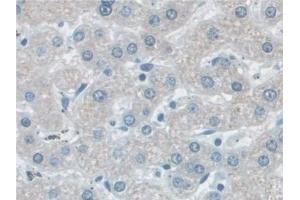 Detection of VCP in Human Liver Tissue using Polyclonal Antibody to Valosin Containing Protein (VCP) (VCP 抗体  (AA 125-371))