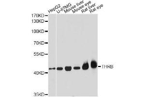 Western blot analysis of extracts of various cell lines, using THRB antibody. (THRB 抗体  (AA 1-250))