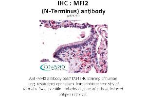 Image no. 2 for anti-Antigen P97 (Melanoma Associated) Identified By Monoclonal Antibodies 133.2 and 96.5 (MFI2) (N-Term) antibody (ABIN1736928) (MFI2 抗体  (N-Term))