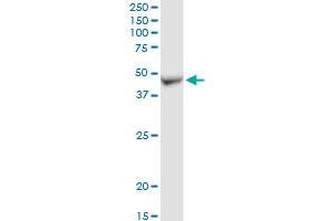ADHFE1 MaxPab rabbit polyclonal antibody. (ADHFE1 抗体  (AA 1-419))