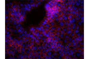 Immunofluorescence (IF) image for anti-Epithelial Cell Adhesion Molecule (EPCAM) antibody (Alexa Fluor 647) (ABIN2657756) (EpCAM 抗体  (Alexa Fluor 647))