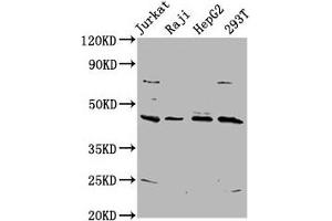 Western Blot Positive WB detected in: Jurkat whole cell lysate, Raji whole cell lysate, HepG2 whole cell lysate, 293T whole cell lysate All lanes: SPO11 antibody at 5. (SPO11 抗体  (AA 28-109))